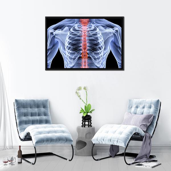 X-Ray Of Men Torso Canvas Wall Art-5 Horizontal-Gallery Wrap-22" x 12"-Tiaracle