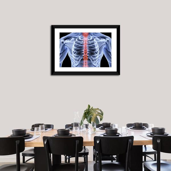 X-Ray Of Men Torso Canvas Wall Art-3 Horizontal-Gallery Wrap-25" x 16"-Tiaracle