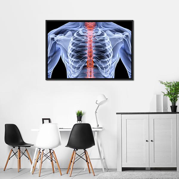 X-Ray Of Men Torso Vertical Canvas Wall Art-3 Vertical-Gallery Wrap-12" x 25"-Tiaracle