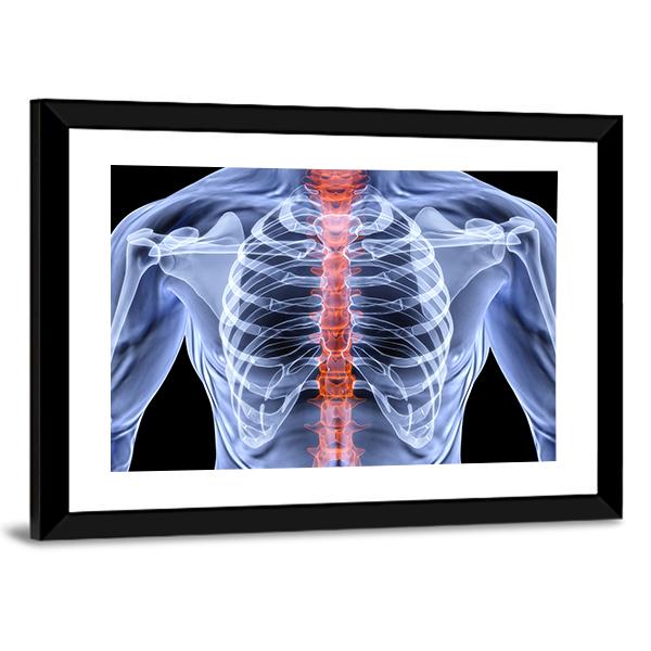 X-Ray Of Men Torso Vertical Canvas Wall Art-3 Vertical-Gallery Wrap-12" x 25"-Tiaracle