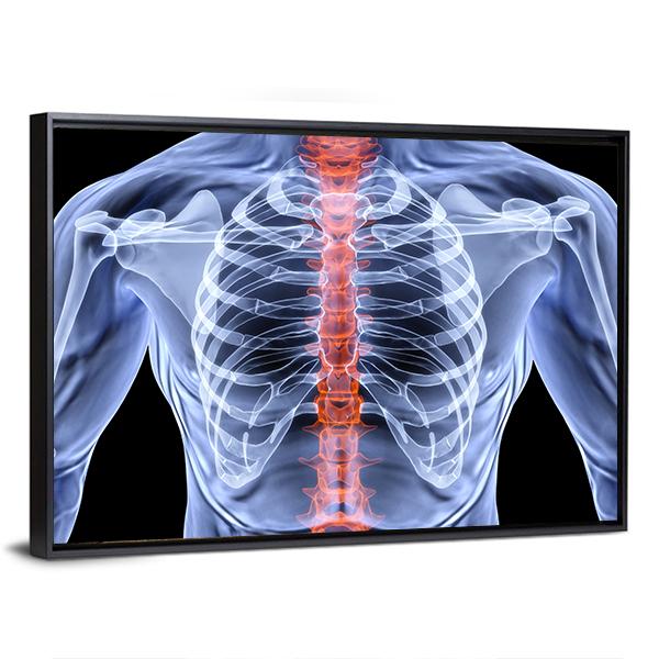 X-Ray Of Men Torso Vertical Canvas Wall Art-3 Vertical-Gallery Wrap-12" x 25"-Tiaracle