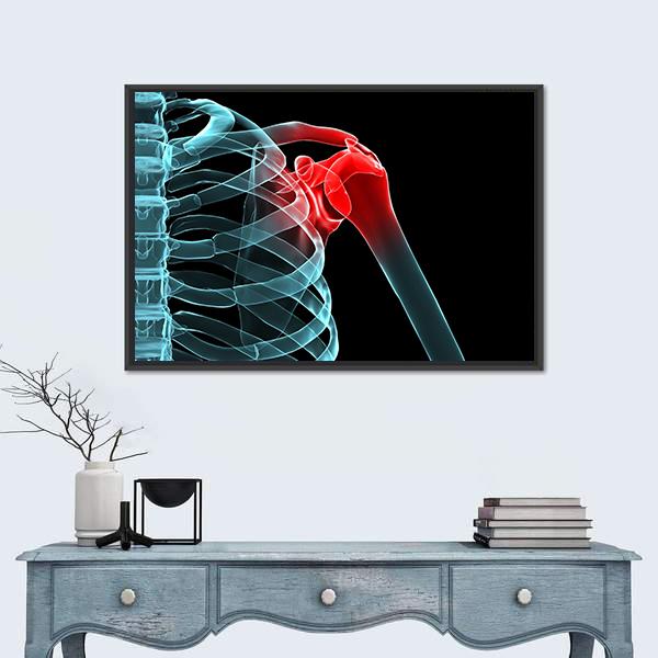 X-Ray Of Painful Shoulder Canvas Wall Art-1 Piece-Floating Frame-24" x 16"-Tiaracle