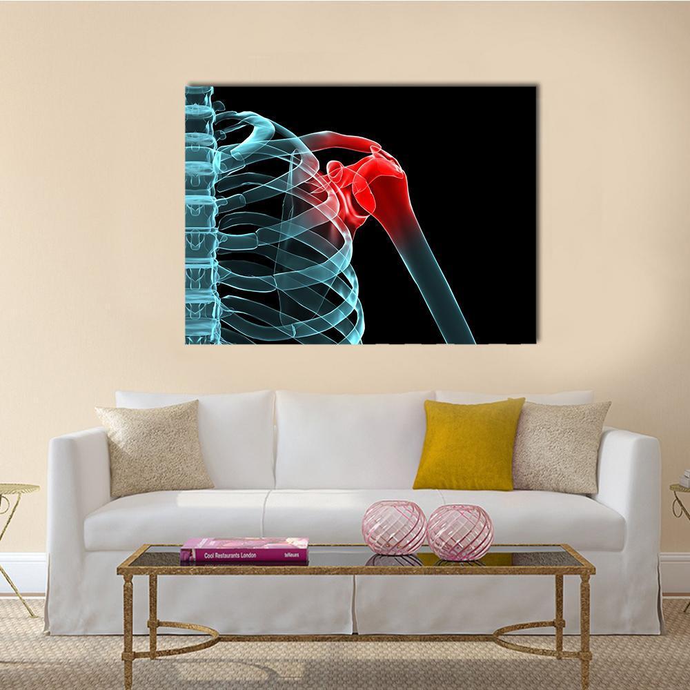 Painful Shoulder X-ray Canvas Wall Art in black, red and blue, single panel hung on a wall