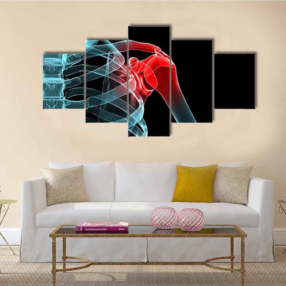 X-Ray Of Painful Shoulder Canvas Wall Art-1 Piece-Gallery Wrap-48" x 32"-Tiaracle