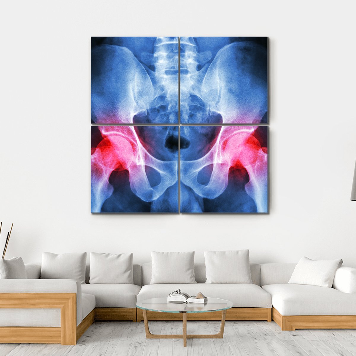 X-Ray Of Pelvis Canvas Wall Art-4 Square-Gallery Wrap-17" x 17"-Tiaracle