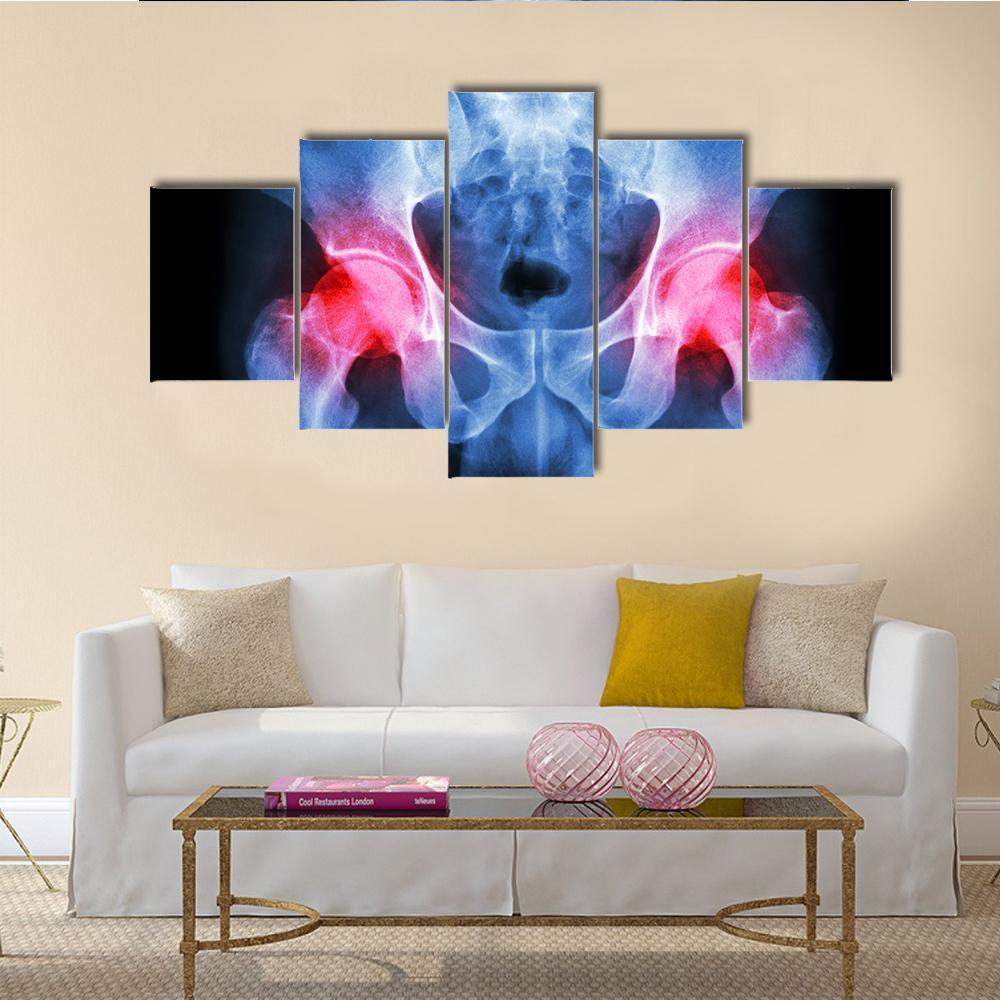 X-Ray Of Pelvis Canvas Wall Art-5 Star-Gallery Wrap-62" x 32"-Tiaracle
