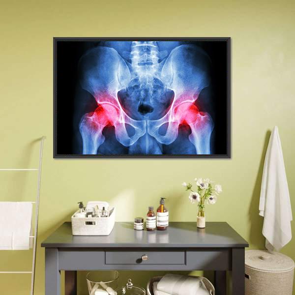 X-Ray Of Pelvis Canvas Wall Art-1 Piece-Floating Frame-24" x 16"-Tiaracle