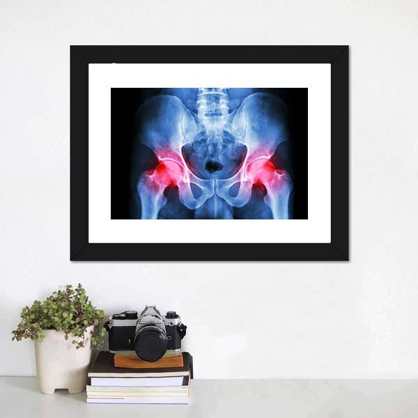 X-Ray Of Pelvis Canvas Wall Art-1 Piece-Framed Print-20" x 16"-Tiaracle