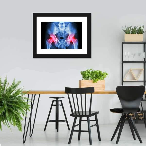X-Ray Of Pelvis Canvas Wall Art-3 Horizontal-Gallery Wrap-25" x 16"-Tiaracle