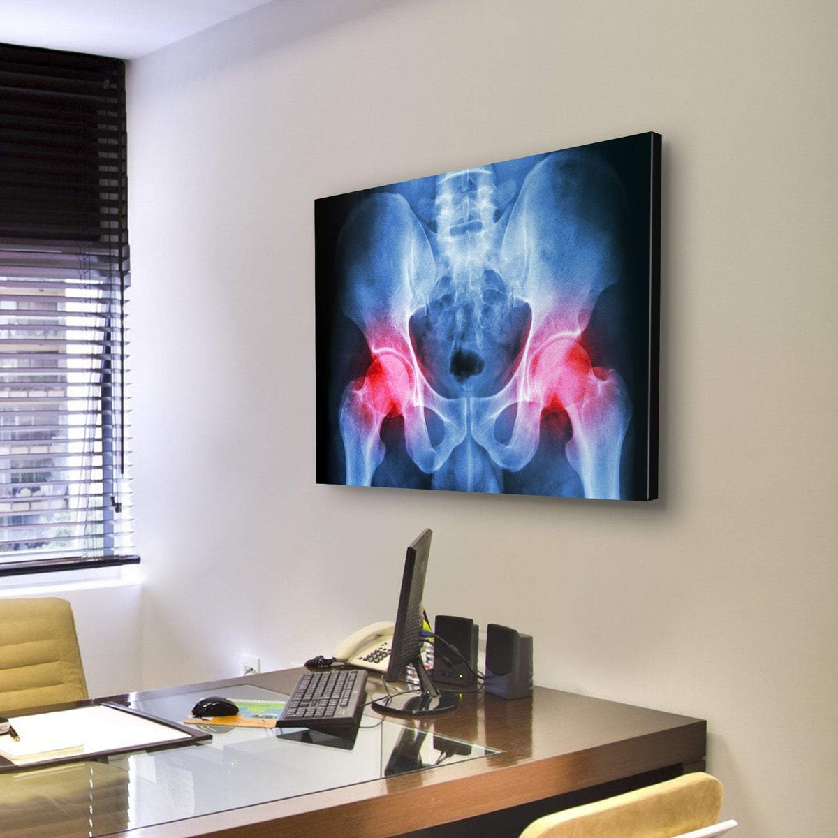 X-Ray Of Pelvis Canvas Wall Art-3 Horizontal-Gallery Wrap-25&quot; x 16&quot;-Tiaracle