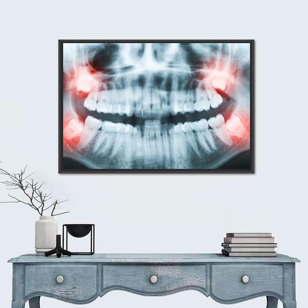 X-Ray Of Teeth And Mouth Canvas Wall Art-1 Piece-Floating Frame-24" x 16"-Tiaracle