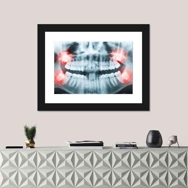 X-Ray Of Teeth And Mouth Canvas Wall Art-1 Piece-Framed Print-20" x 16"-Tiaracle