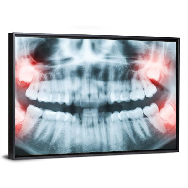 X-Ray Of Teeth And Mouth Canvas Wall Art-3 Horizontal-Gallery Wrap-25" x 16"-Tiaracle