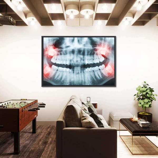 X-Ray Of Teeth And Mouth Canvas Wall Art-5 Horizontal-Gallery Wrap-22" x 12"-Tiaracle