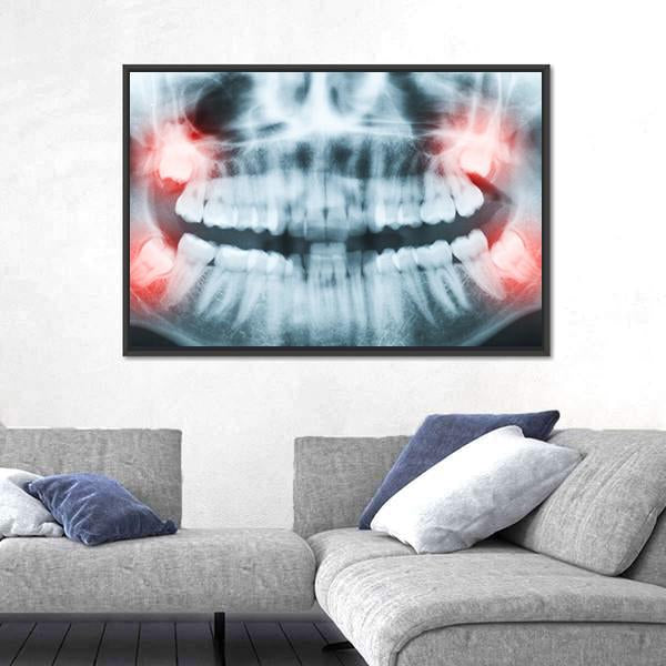 X-Ray Of Teeth And Mouth Canvas Wall Art-5 Horizontal-Gallery Wrap-22" x 12"-Tiaracle