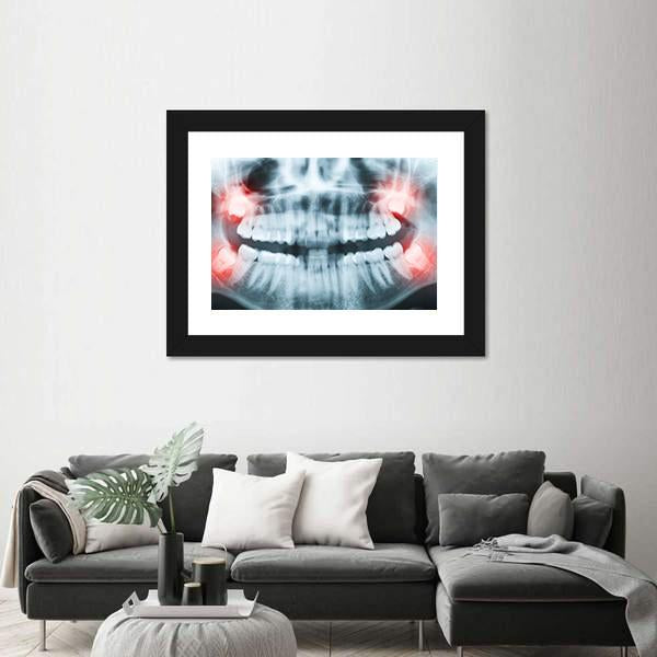 X-Ray Of Teeth And Mouth Canvas Wall Art-5 Horizontal-Gallery Wrap-22&quot; x 12&quot;-Tiaracle