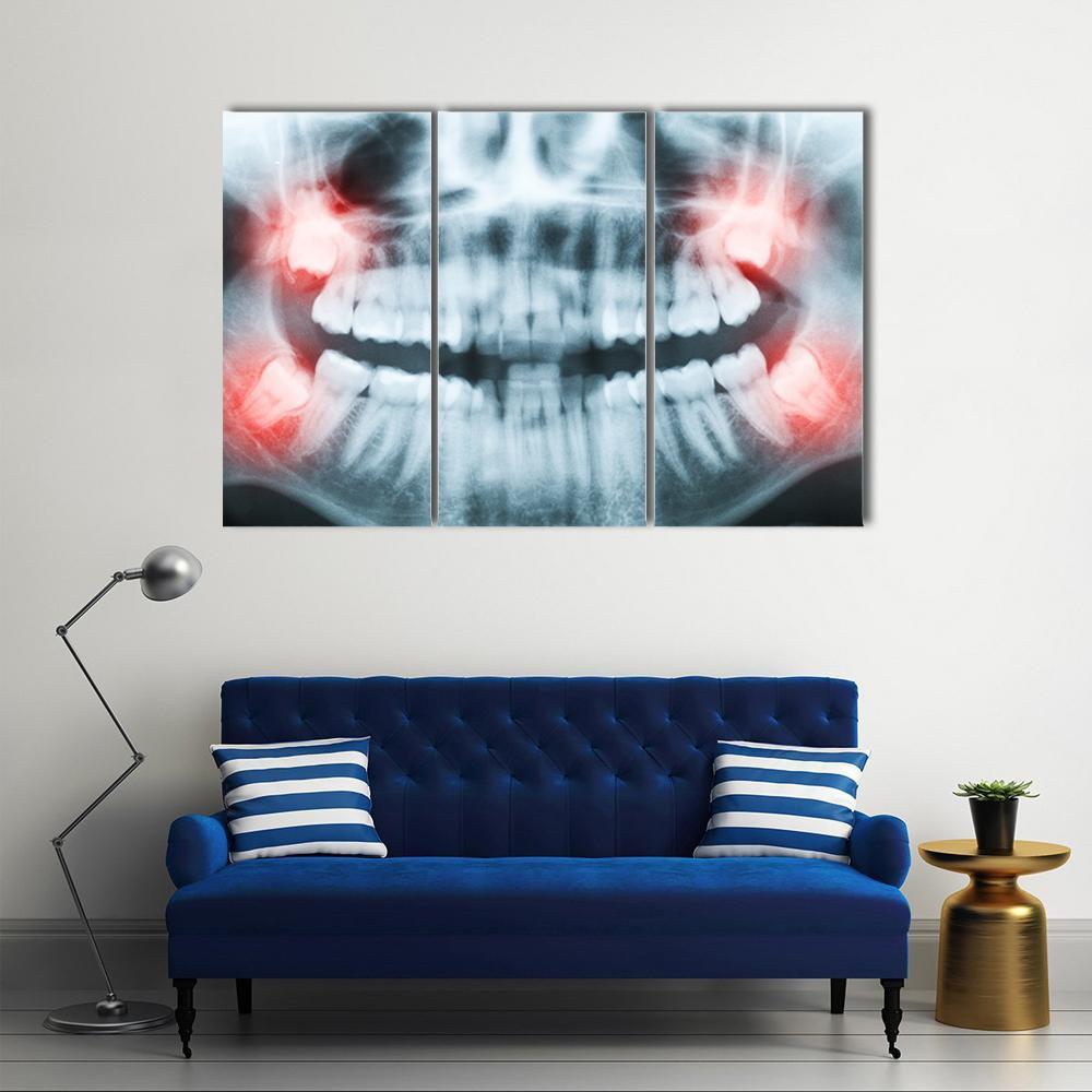 X-Ray Of Teeth And Mouth Canvas Wall Art-3 Horizontal-Gallery Wrap-37" x 24"-Tiaracle