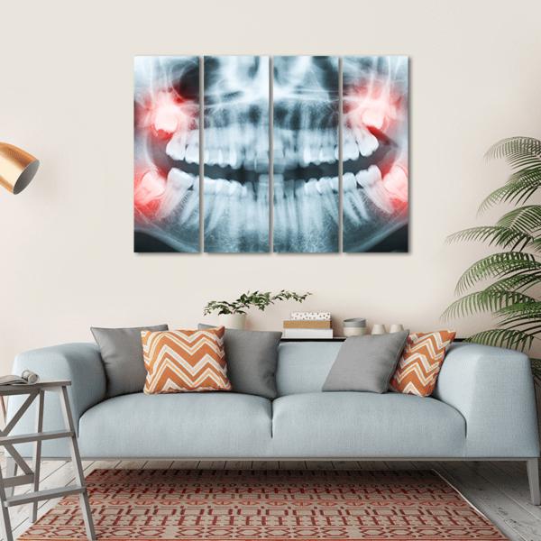 X-Ray Of Teeth And Mouth Canvas Wall Art-4 Horizontal-Gallery Wrap-34&quot; x 24&quot;-Tiaracle