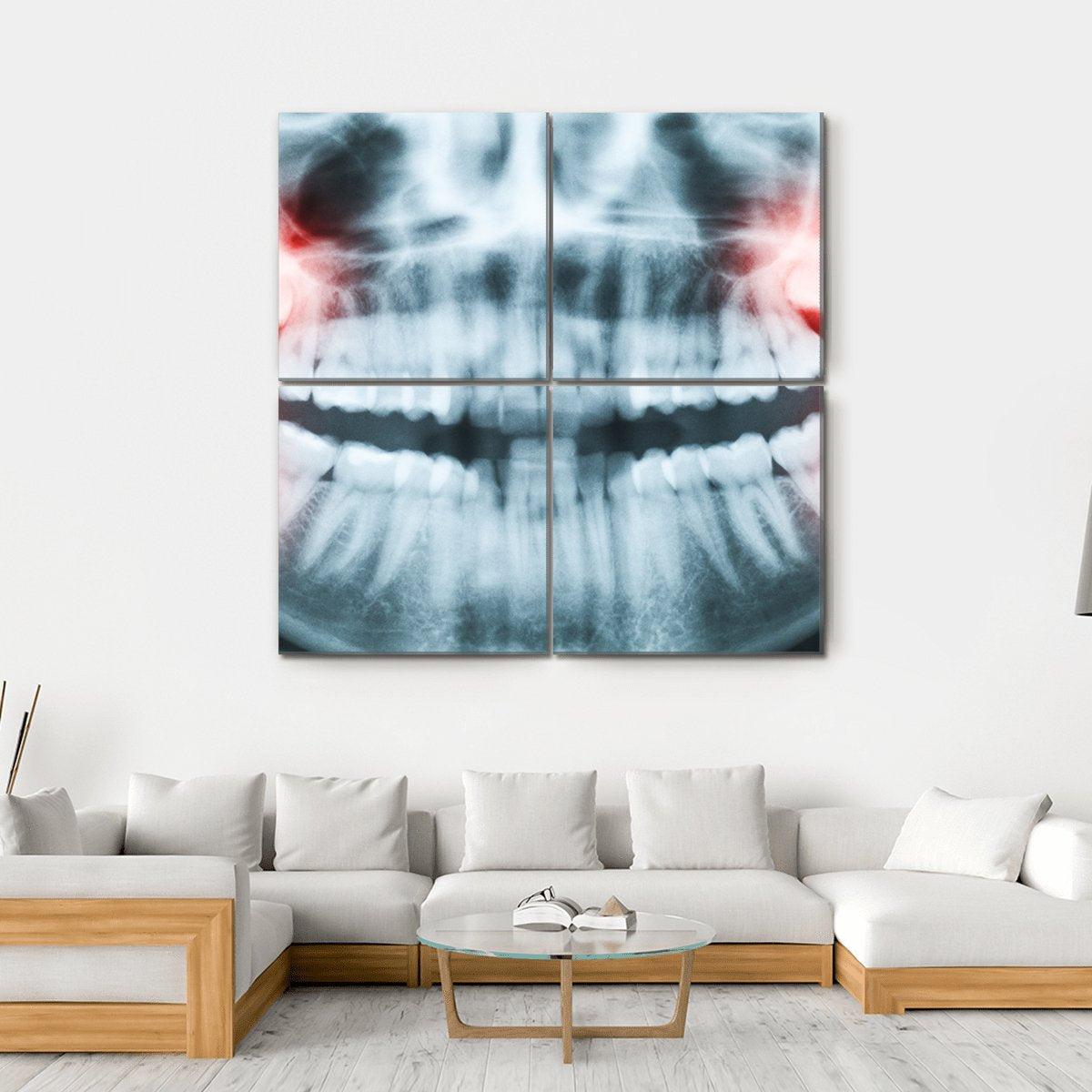 X-Ray Of Teeth And Mouth Canvas Wall Art-4 Square-Gallery Wrap-17&quot; x 17&quot;-Tiaracle