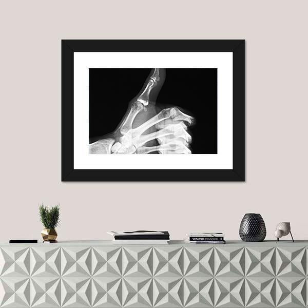 X-Ray Of Thumb Up Canvas Wall Art-1 Piece-Framed Print-20" x 16"-Tiaracle