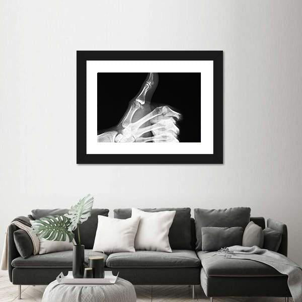 X-Ray Of Thumb Up Canvas Wall Art-5 Horizontal-Gallery Wrap-22" x 12"-Tiaracle