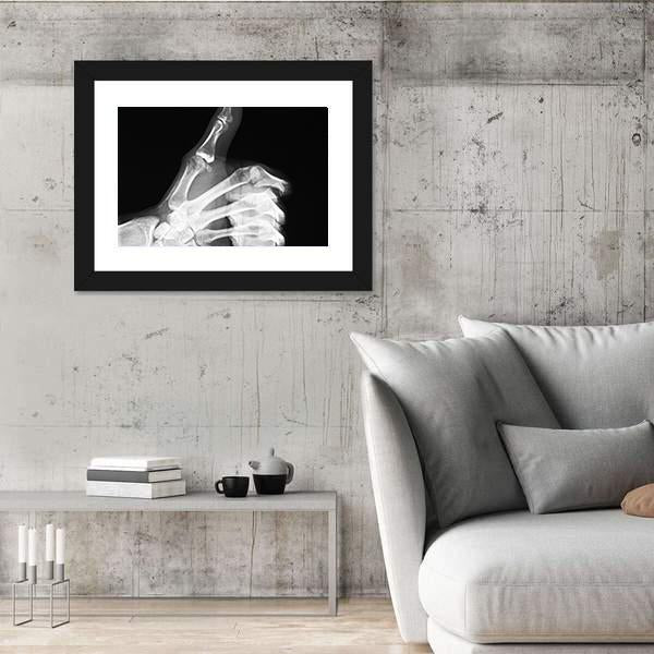 X-Ray Of Thumb Up Canvas Wall Art-5 Horizontal-Gallery Wrap-22" x 12"-Tiaracle
