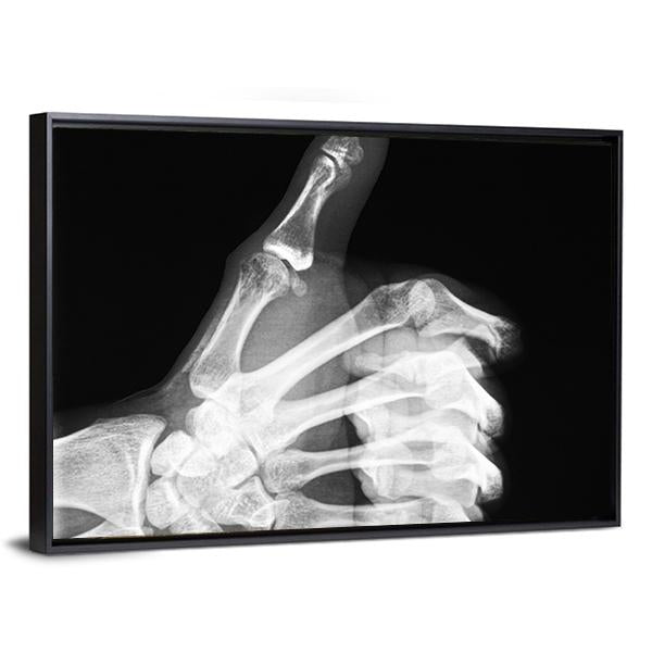 X-Ray Of Thumb Up Canvas Wall Art-5 Horizontal-Gallery Wrap-22" x 12"-Tiaracle