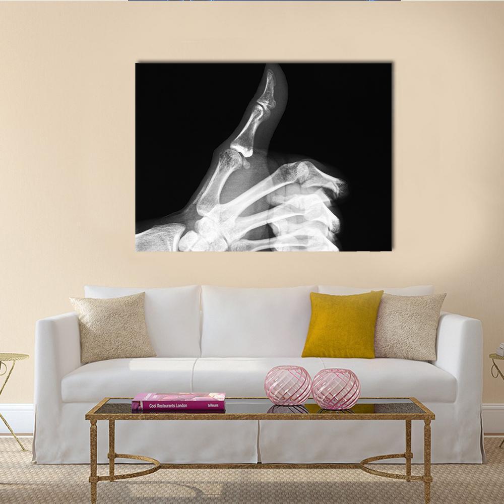 Thumb X-ray Study Canvas Wall Art in black, white and gray, single panel hung on a wall