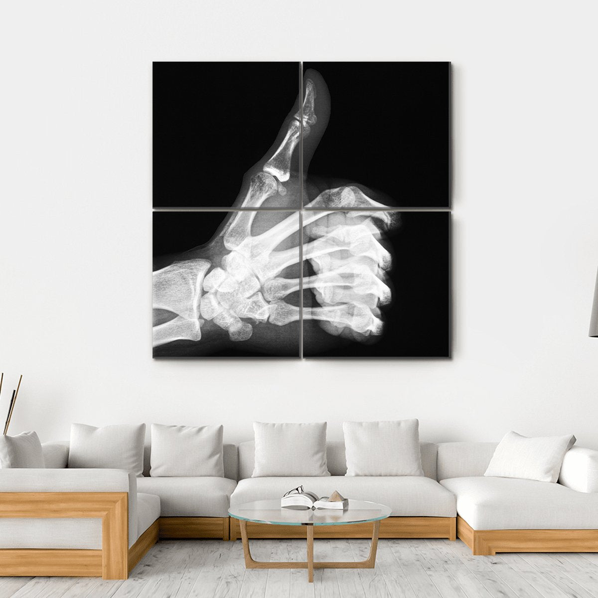 X-Ray Of Thumb Up Canvas Wall Art-4 Square-Gallery Wrap-17" x 17"-Tiaracle