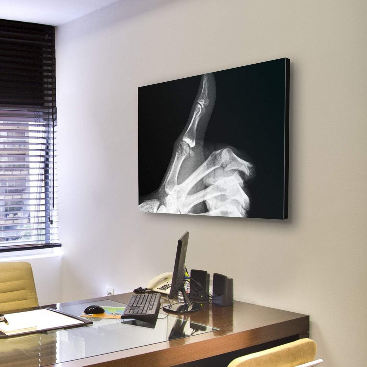 X-Ray Of Thumb Up Canvas Wall Art-3 Horizontal-Gallery Wrap-25" x 16"-Tiaracle