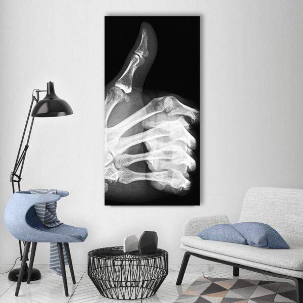 Thumbs-up Hand X-ray Vertical Canvas Wall Art in black and white, single vertical panel hung on a wall