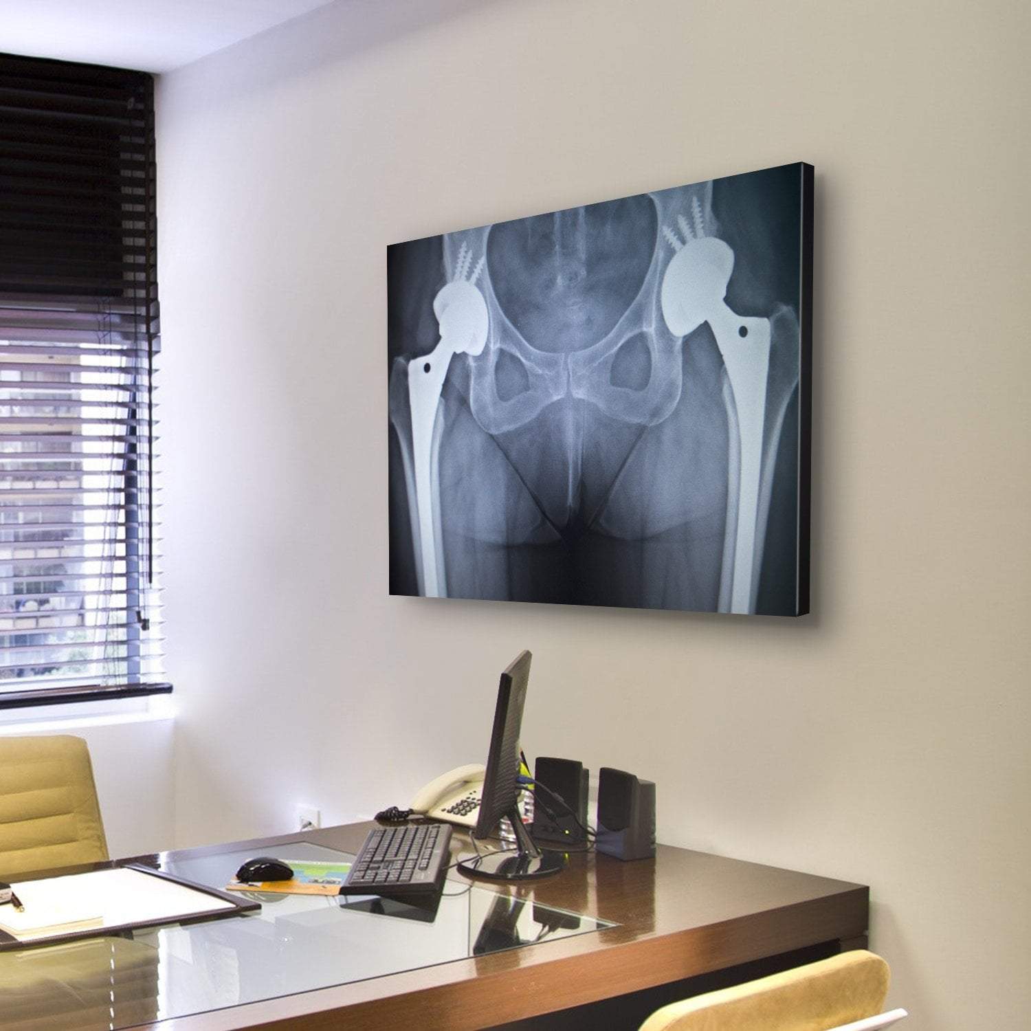 X-Ray Scan Image Of Hip Joints Canvas Wall Art-3 Horizontal-Gallery Wrap-37" x 24"-Tiaracle